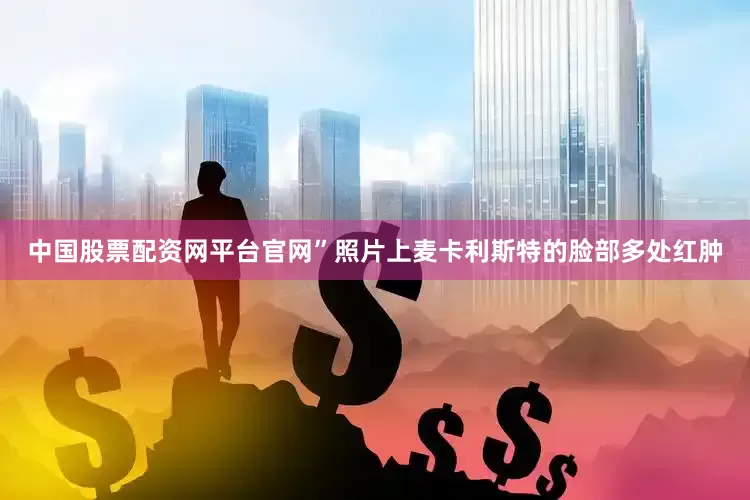中国股票配资网平台官网”照片上麦卡利斯特的脸部多处红肿